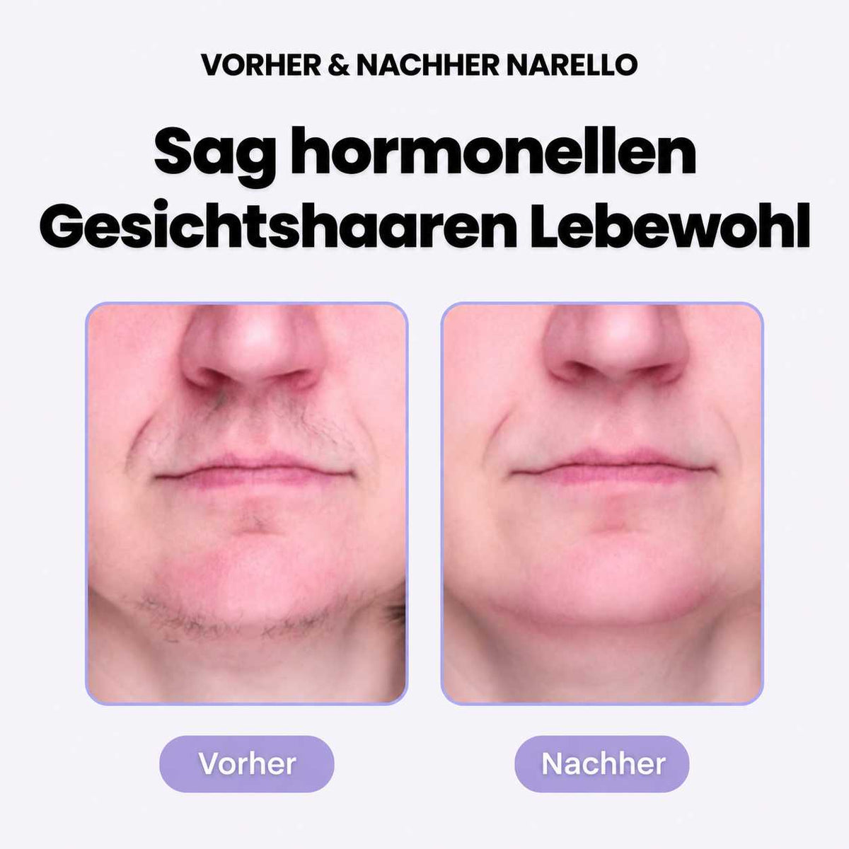 Narello FacePluck | Gesichtshaarentferner