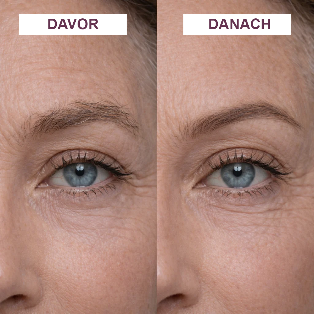 BrowGlow | Perfekte Augenbrauen